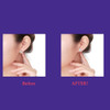 Hypoallergenic Earring Lifter
