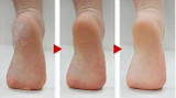 Sleeq Foot Care Tool