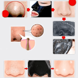 Amazing Blackhead Removal Deep Cleaning Face Mask It's WONDERFUL