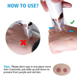Blackhead Remover - Diamond Microdermabrasion Skin Peeling
