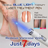 Blue Light Therapy Acne Laser Pen -  Facial Massage Treatment
