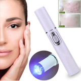 Blue Light Therapy Acne Laser Pen -  Facial Massage Treatment