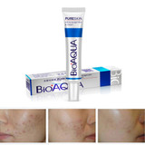 Acne Scar Remove Cream Face Care Whitening Moisturizing Face Cream Skin Care