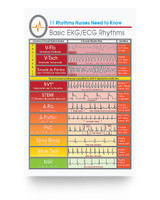 AZTeam Customized Poster Gifts to My Daughter in Law Cardiologist Basic EKG ECG Rhythms Vertical Poster Great for Daughter Poster Prints Home Decor Wall Art Kitchen, Living Room Décor AZTeam Customized Poster Gifts to My Daughter in Law Cardiologist Basic EKG ECG Rhythms Vertical Poster Great for Daughter Poster Prints Home Decor Wall Art Kitchen, Living Room Décor