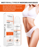 Ingrown Hairs treatment