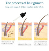 Shaping Hair Growth for Beard