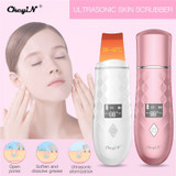 Ultrasonic Skin Scrubber Warmer Facial Cleanser Dirt Blackhead Removal