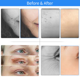 Maglev Plasma Pen Eyelid Lifting Pen Laser Plasma Tattoo Freckle Dark Spot Remover Wart Removal Beauty Machine With 3pcs Needle