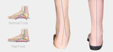Premium Orthopedic Insoles