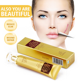 Stretch Marks Remove  Acne Scar Treatment Whitening Cream Pimple Scar Pregnancy Nourish Skin Care