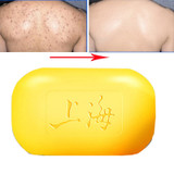 Shanghai sulfur soap oil-control acne treatment blackhead remover soap 90g Whitening cleanser Chinese traditional Skin care