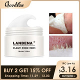 LANBENA Blackhead Remover Face Mask Pore Strip Black Peeling Nose Mask Acne Treatment Unisex Deep Cleansing Skin Care Beauty