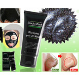 Blackhead Facial Masks