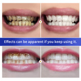 BREYLEE Teeth Whitening Powder Toothpaste Dental Teeth Cleaning Oral Hygiene Remove Plaque Tooth Whiten Brighten Powder TSLM1
