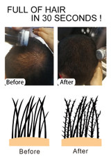 Sevich Anti Hair Loss/Growth Powder