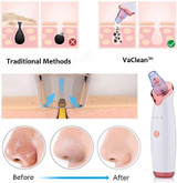 Blackhead Removal Tool