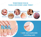 Fungal Nail Treatment Pen Anti Infection Gel Foot Toe Nail
