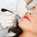 Tattoo Remover Intelligent Laser Picosecond Pen