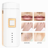 Professional Electric Epilator Laser Hair Removal