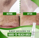 Semi-permanent Hair Removal Spray