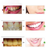 Stain-Free Teeth Whitener Toothpaste