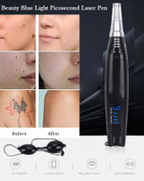 Beauty Blue Light Picosecond Laser Pen