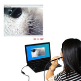 Ear Cleaning Endoscope