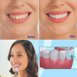 Professional Tooth Stain Eraser