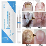 FUNGAL NAIL REPAIR PEN