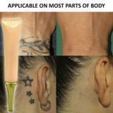 Permanent Tattoo Removal Cream