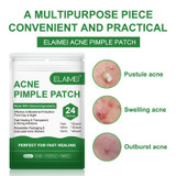 Effective Pimple Master Patch Facial Invisible Sticker Treatment Beauty Mask