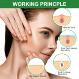 Effective Pimple Master Patch Facial Invisible Sticker Treatment Beauty Mask