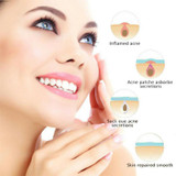 Invisible Oil Control Isolation Acne Concealer Acne Pimple Sticker