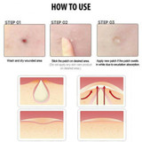 Invisible Oil Control Isolation Acne Concealer Acne Pimple Sticker