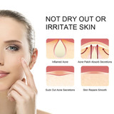Invisible Oil Control Isolation Acne Concealer Acne Pimple Sticker