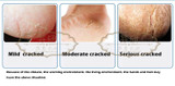 Original Cosmetics Anti Dry Hand Foot Crack Cream