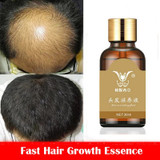 Fast Hair Growth Essence Hair Loss Products