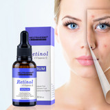 30ml Anti Aging/Wrinkle Skin Lightening Vitamin E + Retinol Serum