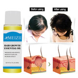 Hair Growth Essence Hair Loss Liquid Ginger Extract Hair Tonic Fast Sunburst Hair Growth Essence Original Authentic 100% TSLM2