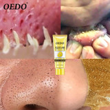 Remove Blackhead Mask Shrink Pore Improve Rough Skin Acne Shills Blackhead Remover Mask