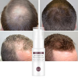 Hair Growth Essence Essential Spray