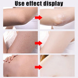 Best Exfoliating Body Gel