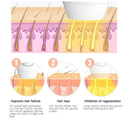 Laser HD professional permanent IPL epilator laser hair removal 600000 flash machine