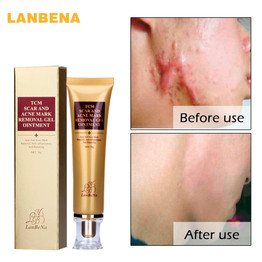 LANBENA 30ml Acne Scar Removal Cream Skin Repair Face Cream Acne Spots Acne Treatment Blackhead Whitening Cream Stretch Marks