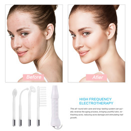 CLENCE™  |  High Frequency Facial Wand Anti-Wrinkle Free