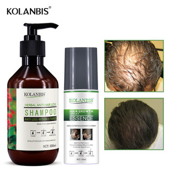 Hair Loss Treatment Kit Oily Growth Fast Serum Hair Loss Shampoo Men Baldness Thickening Product Alopecia Restoration Anti Fall