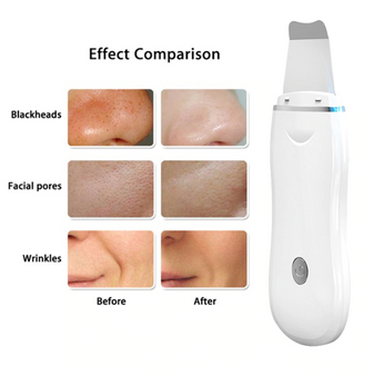 Ultrasonic Peeling Facial Clean Skin Scrubber Deep Cleaning, Exfoliators, Skin Rejuvenation Rechargeable