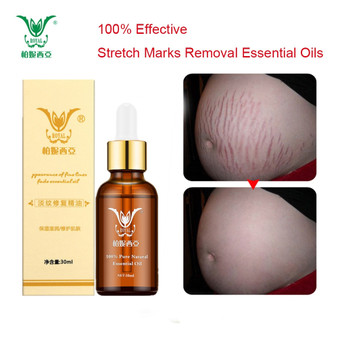 Stretch Marks Removal Essential Oils Pure Natural Stretch Marks Remover Obesity Postpartum Anti-wrinkle Repair Cream  Skin Care