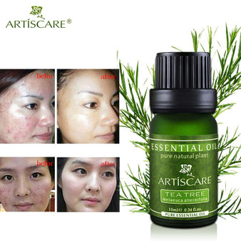 ARTISCARE pure tea tree essential oil for the face care acne treatment oil blackhead remover anti scar spots facial massage oil