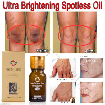 Ultra Brightening Spotless Oil Skin Care Dark Spots Remove Ance Burn Strentch Marks Scar Removal Brightening Skin Essence 10ml